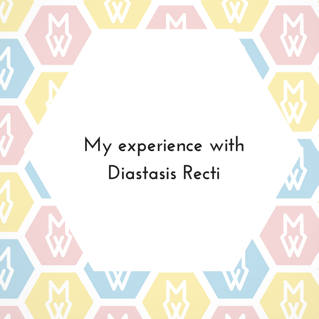 My experience with Diastasis Recti